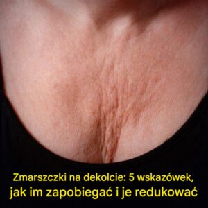 dekolt