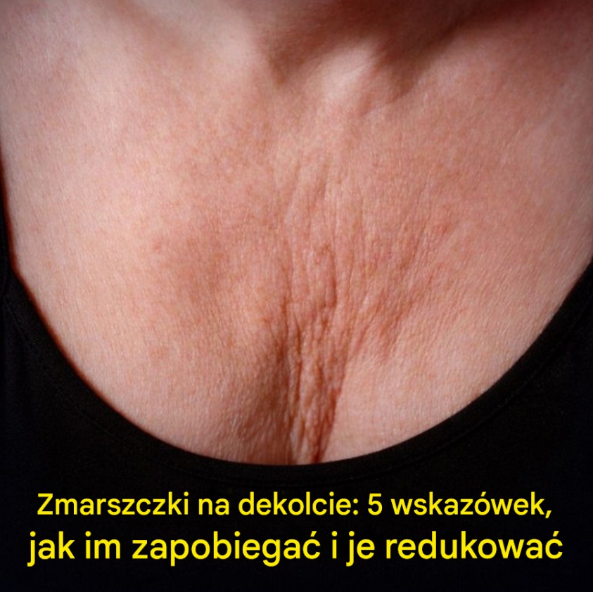 dekolt