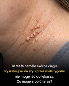 narosle