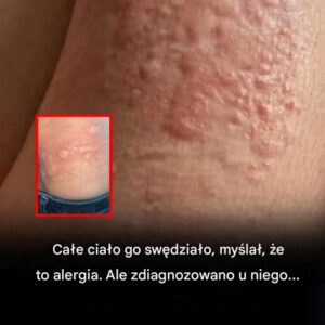 swedzialo