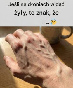 zyly