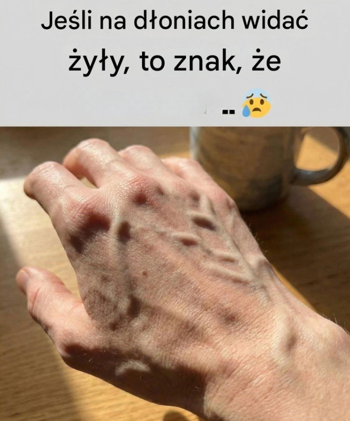 zyly