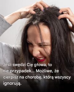 glowa