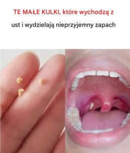 kulki