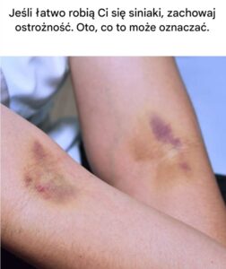 latwo