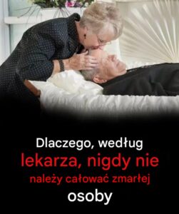 nie calowac