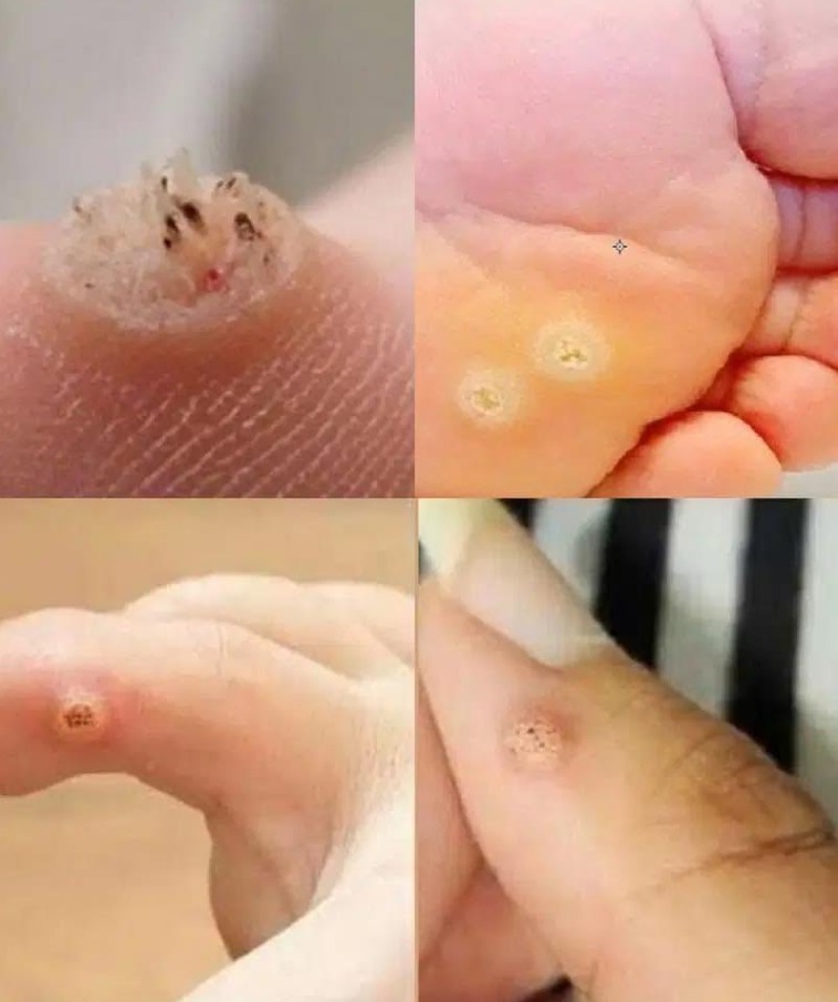 pieprz
