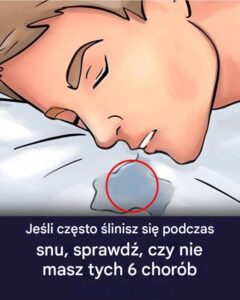 slinienie