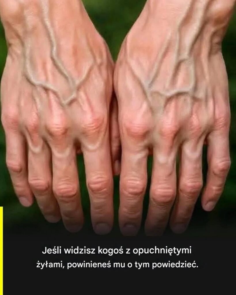 zyly