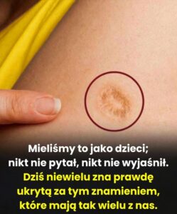 blizna