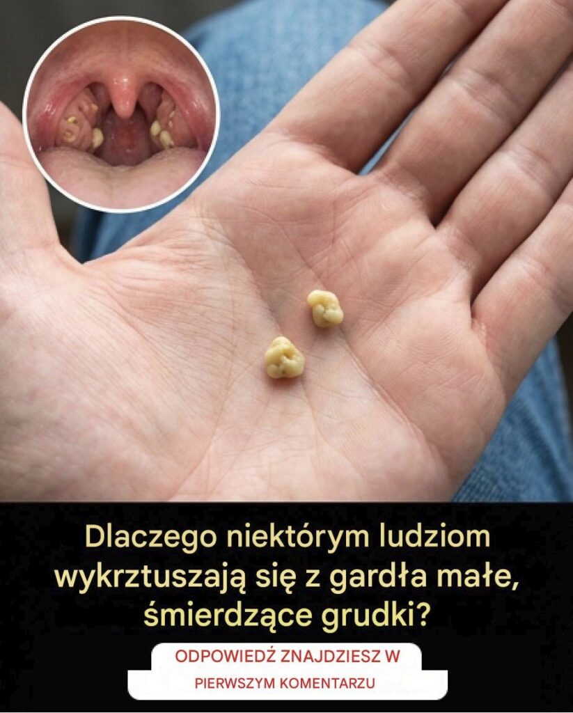 grudki