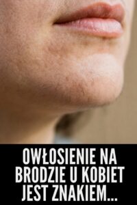 owlosienie
