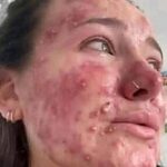 Zmiany skórne na twarzy – od czego się biorą i jak je leczyć?