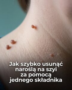 narosla