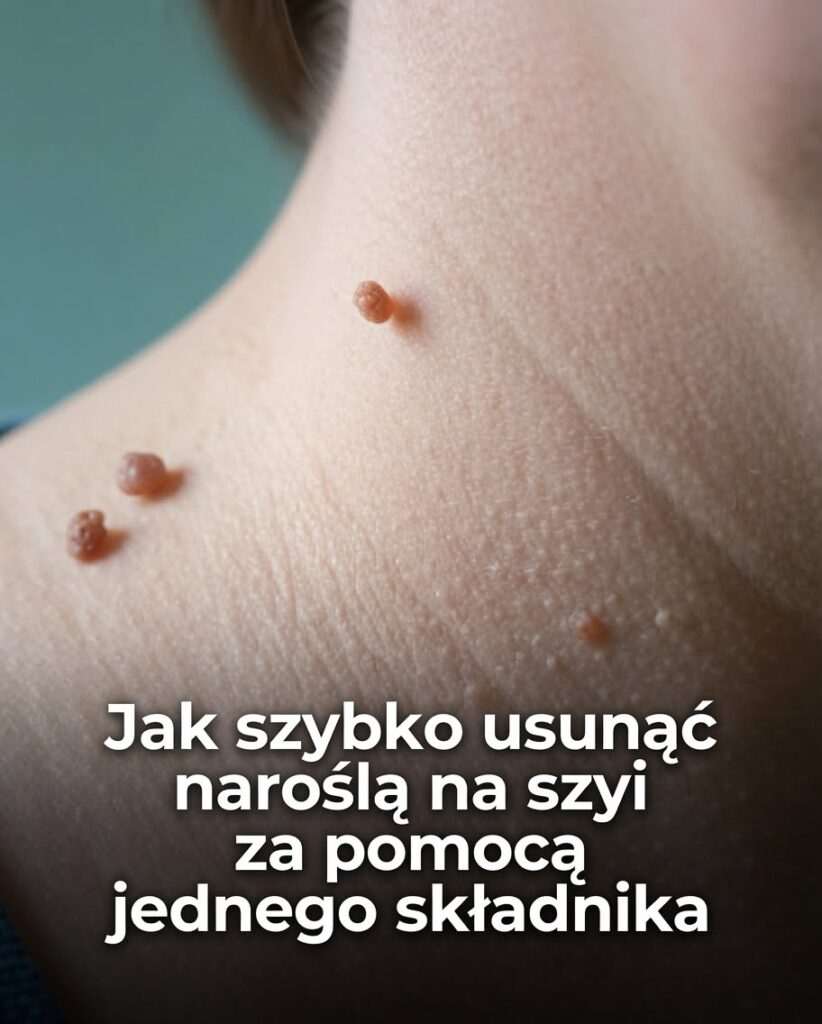 narosla
