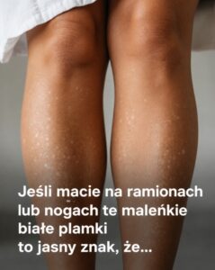 plamki